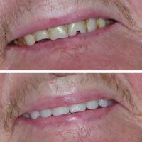 Burton Denture Clinic