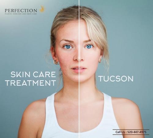 Skin Care Treatment - Perfection Plastic Surgery