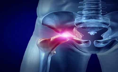 Cedar Orthopaedic Surgery Center - Least Expensive Total Hip Replacement