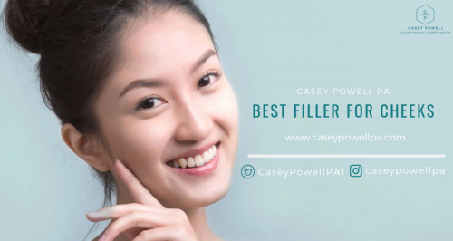 Best Filler For Cheeks | Casey Powell PA