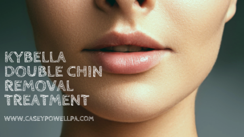 Kybella Santa Monica - Casey Powell PA