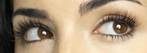 can stress cause eyelash hair loss