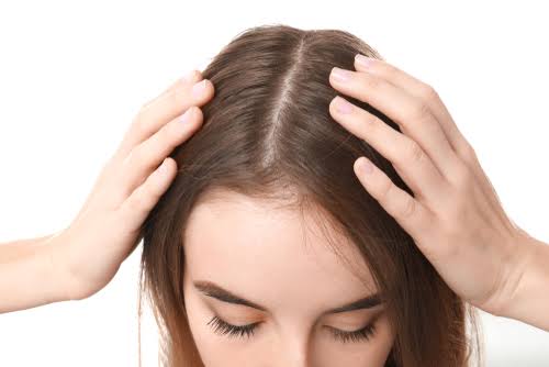 female hair loss