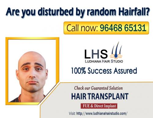 Hair Transplant in Ludhiana
