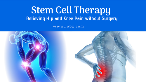 Get Best Stem Cell Therapy - iOBX