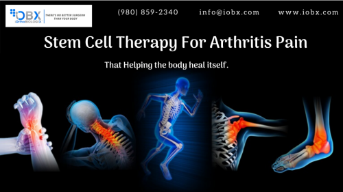 Arthritis Stem Cell