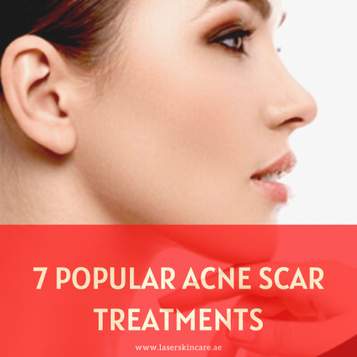 7 Popular Acne Scar Treatments