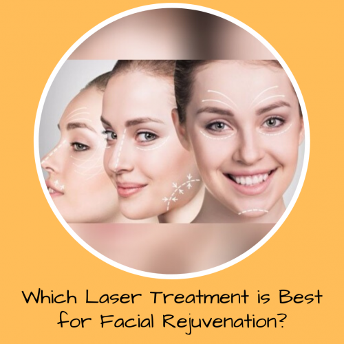 Which Laser Treatment is Best for Facial Rejuvenation