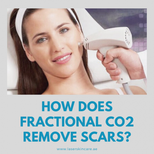 How Does Fractional CO2 Remove Scars_