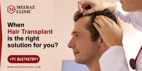 How To Find Best Hair Transplant Surgeon For You