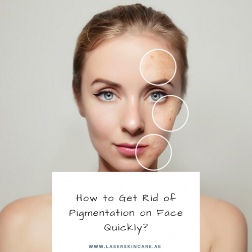 How to Get Rid of Pigmentation on Face Quickly