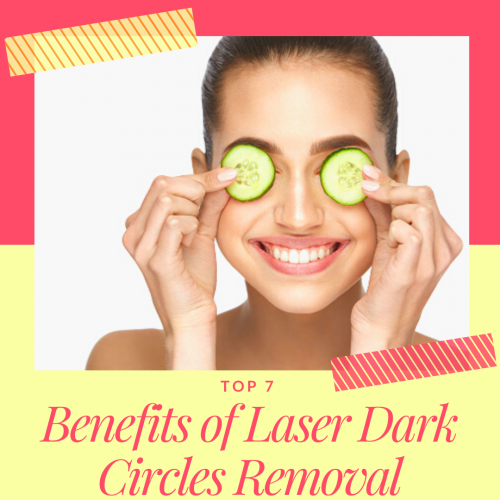 Top 7 Benefits of Laser Dark Circles Removal