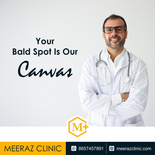 The best solution for hair transplantation for women