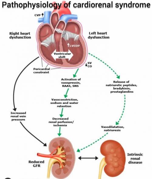 interactions between heart disease and kidney disease