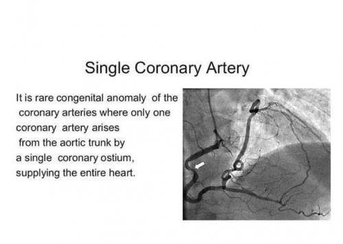 single coronary artery