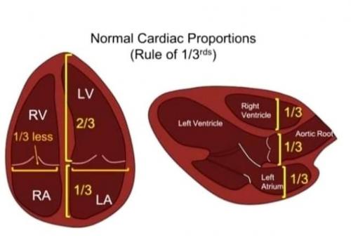 normal cardiac proportion