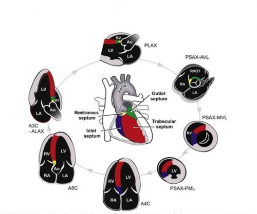 Echocardiographic View