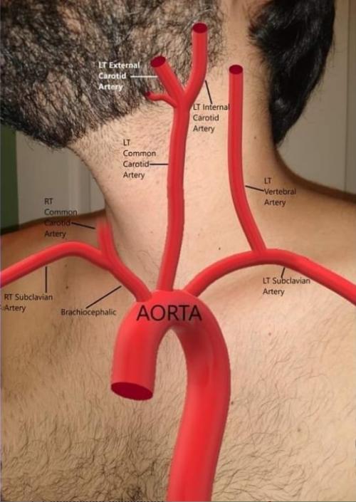 Branches of Aortic Arch