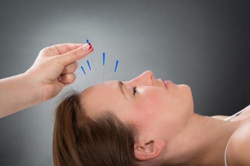 Get Your Best Acupuncture Treatment In Boca Raton