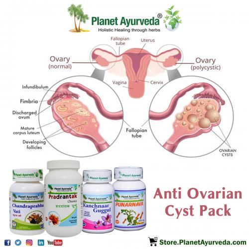 Anti-Ovarian Cyst Pack - Herbal Remedies for Ovarian Cyst Treatment