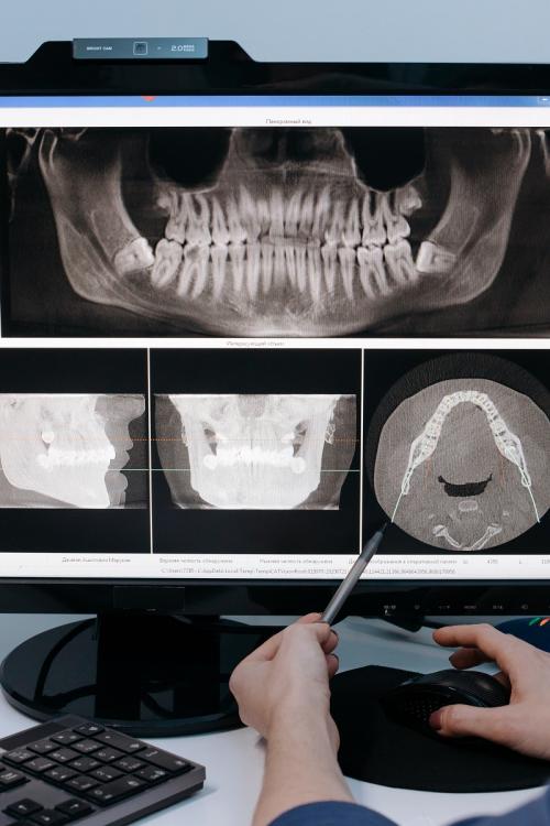 Best Affordable Dentist In Palmdale | AV Dental