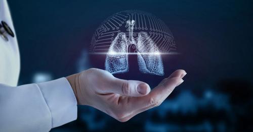 Japan Idiopathic Pulmonary Fibrosis Treatment Market1