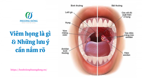 benh-viem-hong-la-gi