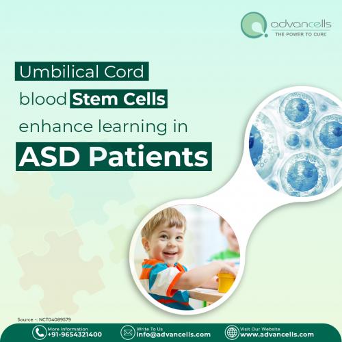 Umbilical Cord Stem Cell
