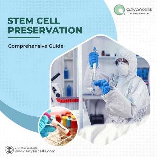 Stem-Cell-Preservation