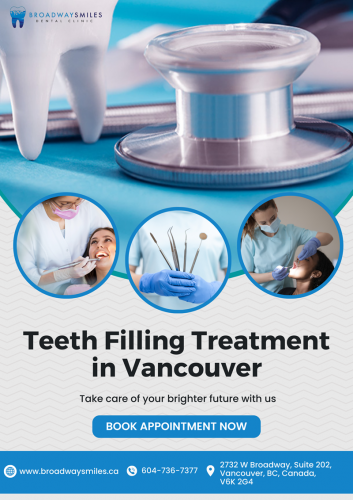 Teeth Filling Treatment in Vancouver