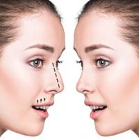 Cosmetic Surgery